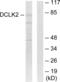 Serine/threonine-protein kinase DCLK2 antibody, abx013694, Abbexa, Western Blot image 