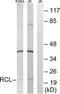Deoxyribonucleoside 5 -monophosphate N-glycosidase antibody, TA315078, Origene, Western Blot image 