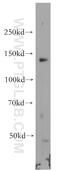 RNA Polymerase II Subunit B antibody, 20370-1-AP, Proteintech Group, Western Blot image 