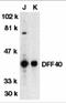 DNA fragmentation factor subunit beta antibody, 2153, ProSci, Western Blot image 