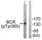 BCR Activator Of RhoGEF And GTPase antibody, LS-C198681, Lifespan Biosciences, Western Blot image 