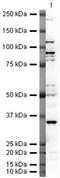 Oxidized Low Density Lipoprotein Receptor 1 antibody, PA5-19804, Invitrogen Antibodies, Western Blot image 