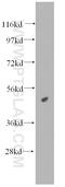 Histone Acetyltransferase 1 antibody, 11432-1-AP, Proteintech Group, Western Blot image 
