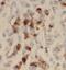 Cathepsin E antibody, FNab10702, FineTest, Immunohistochemistry paraffin image 