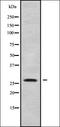 Carcinoembryonic Antigen Related Cell Adhesion Molecule 7 antibody, orb338142, Biorbyt, Western Blot image 