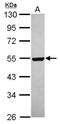 GA Binding Protein Transcription Factor Subunit Beta 1 antibody, NBP2-16572, Novus Biologicals, Western Blot image 