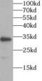 ON antibody, FNab08153, FineTest, Western Blot image 