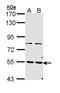 Calcium/calmodulin-dependent 3 ,5 -cyclic nucleotide phosphodiesterase 1A antibody, LS-C186226, Lifespan Biosciences, Western Blot image 