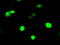 Rho GDP-dissociation inhibitor 1 antibody, TA501120, Origene, Immunofluorescence image 