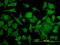 Fortilin antibody, LS-C198363, Lifespan Biosciences, Immunofluorescence image 
