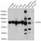 Sec1 Family Domain Containing 1 antibody, GTX66543, GeneTex, Western Blot image 