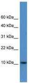DnaJ Heat Shock Protein Family (Hsp40) Member C19 antibody, TA342749, Origene, Western Blot image 