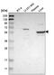TBC1 Domain Family Member 10A antibody, NBP2-58911, Novus Biologicals, Western Blot image 