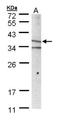 MHC Class I Polypeptide-Related Sequence A antibody, NBP1-32830, Novus Biologicals, Western Blot image 