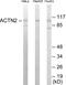 Actinin Alpha 2 antibody, EKC1712, Boster Biological Technology, Western Blot image 