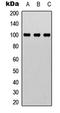 RB Binding Protein 8, Endonuclease antibody, LS-C368496, Lifespan Biosciences, Western Blot image 