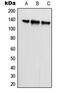SR-Related CTD Associated Factor 1 antibody, GTX55206, GeneTex, Western Blot image 