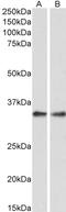 Serine/threonine-protein phosphatase 4 catalytic subunit antibody, LS-B3614, Lifespan Biosciences, Western Blot image 