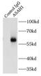 N-Acylsphingosine Amidohydrolase 1 antibody, FNab00618, FineTest, Immunoprecipitation image 