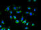 Uracil nucleotide/cysteinyl leukotriene receptor antibody, A59290-100, Epigentek, Immunofluorescence image 