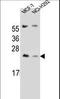 Protein lin-7 homolog C antibody, LS-C165785, Lifespan Biosciences, Western Blot image 
