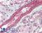 Myosin IH antibody, LS-B9571, Lifespan Biosciences, Immunohistochemistry paraffin image 