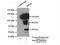 Huntingtin Interacting Protein 1 Related antibody, 16814-1-AP, Proteintech Group, Immunoprecipitation image 