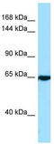 Calcium Voltage-Gated Channel Auxiliary Subunit Alpha2delta 4 antibody, TA337800, Origene, Western Blot image 