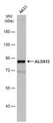 Arachidonate 12-lipoxygenase, 12S-type antibody, PA5-77858, Invitrogen Antibodies, Western Blot image 