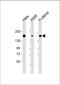 Integrin Subunit Alpha 11 antibody, MA5-24758, Invitrogen Antibodies, Western Blot image 