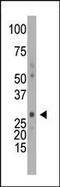 Deoxycytidine Kinase antibody, 62-650, ProSci, Western Blot image 