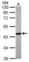 Probable tubulin polyglutamylase TTLL1 antibody, NBP1-32805, Novus Biologicals, Western Blot image 