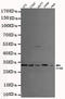 General Transcription Factor IIB antibody, STJ99031, St John