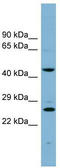 VPS28 Subunit Of ESCRT-I antibody, TA345056, Origene, Western Blot image 