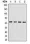 GC Vitamin D Binding Protein antibody, orb378071, Biorbyt, Western Blot image 