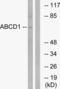 Ald antibody, LS-C119763, Lifespan Biosciences, Western Blot image 