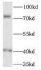 FRAS1 Related Extracellular Matrix 1 antibody, FNab03218, FineTest, Western Blot image 