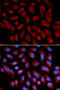 Keratin 7 antibody, 18-719, ProSci, Immunofluorescence image 