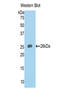 HAVcr-1 antibody, LS-C295029, Lifespan Biosciences, Western Blot image 