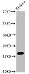 N(Alpha)-Acetyltransferase 38, NatC Auxiliary Subunit antibody, CSB-PA871557LA01HU, Cusabio, Western Blot image 