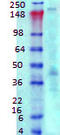 Ankyrin-3 antibody, TA326445, Origene, Western Blot image 