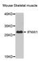 Interferon Omega 1 antibody, orb373965, Biorbyt, Western Blot image 