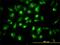 Component Of Oligomeric Golgi Complex 7 antibody, H00091949-M01, Novus Biologicals, Immunofluorescence image 