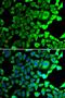 Ubiquitin carboxyl-terminal hydrolase 8 antibody, LS-C346194, Lifespan Biosciences, Immunofluorescence image 