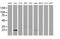 Lin-7 Homolog B, Crumbs Cell Polarity Complex Component antibody, MA5-25208, Invitrogen Antibodies, Western Blot image 