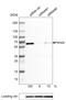 Prolyl 4-hydroxylase subunit alpha-2 antibody, MA5-24599, Invitrogen Antibodies, Western Blot image 