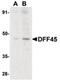 DNA Fragmentation Factor Subunit Alpha antibody, PA5-19878, Invitrogen Antibodies, Western Blot image 