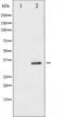 Cyclin Dependent Kinase 1 antibody, TA325340, Origene, Western Blot image 