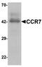 C-C Motif Chemokine Receptor 7 antibody, TA326705, Origene, Western Blot image 