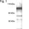 Rod cGMP-specific 3 ,5 -cyclic phosphodiesterase subunit alpha antibody, NB120-5660, Novus Biologicals, Western Blot image 
